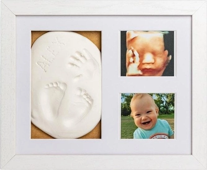 Baby`s print - Photo gallery with