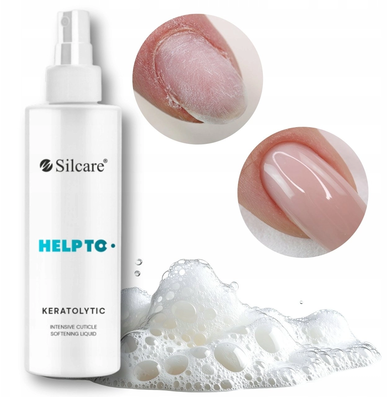 SILCARE_Help To Keratolytic keratolytic liquid 3in1